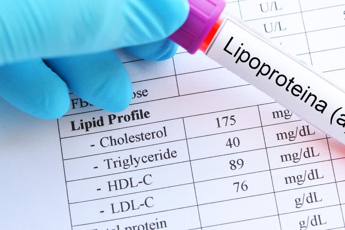Lipoproteina(a): badanie, które warto wykonać przynajmniej raz w życiu